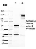Nestin Antibody in SDS-PAGE (SDS-PAGE)