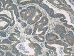 LDLR Antibody in Immunohistochemistry (Paraffin) (IHC (P))