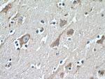 LDLR Antibody in Immunohistochemistry (Paraffin) (IHC (P))