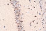 LDLR Antibody in Immunohistochemistry (Paraffin) (IHC (P))