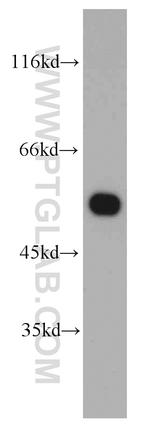 Sestrin 2 Antibody in Western Blot (WB)