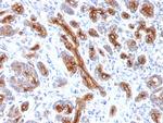 CFTR (Cystic Fibrosis Transmembrane Conductance Regulator) Antibody in Immunohistochemistry (Paraffin) (IHC (P))