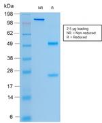 CFTR (Cystic Fibrosis Transmembrane Conductance Regulator) Antibody in SDS-PAGE (SDS-PAGE)