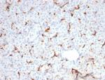 CFTR (Cystic Fibrosis Transmembrane Conductance Regulator) Antibody in Immunohistochemistry (Paraffin) (IHC (P))