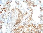 CFTR (Cystic Fibrosis Transmembrane Conductance Regulator) Antibody in Immunohistochemistry (Paraffin) (IHC (P))