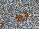 ARF3 Antibody in Immunohistochemistry (Paraffin) (IHC (P))