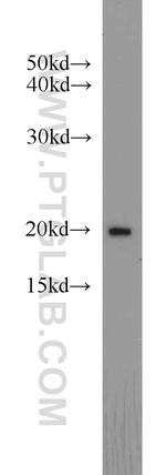 ARF3 Antibody in Western Blot (WB)