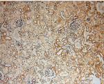 HERP Antibody in Immunohistochemistry (Paraffin) (IHC (P))