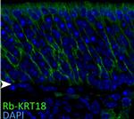 Cytokeratin 18 Antibody in Immunocytochemistry (ICC/IF)