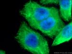 Cytokeratin 18 Antibody in Immunocytochemistry (ICC/IF)