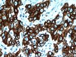 Cytokeratin 18 Antibody in Immunohistochemistry (Paraffin) (IHC (P))