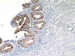 Cytokeratin 18 Antibody in Immunohistochemistry (Paraffin) (IHC (P))