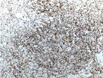 Cytokeratin 18 Antibody in Immunohistochemistry (Paraffin) (IHC (P))