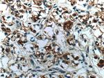 Cytokeratin 18 Antibody in Immunohistochemistry (Paraffin) (IHC (P))