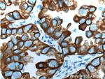 Cytokeratin 18 Antibody in Immunohistochemistry (Paraffin) (IHC (P))