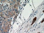 Cytokeratin 18 Antibody in Immunohistochemistry (Paraffin) (IHC (P))