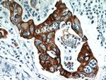 Cytokeratin 18 Antibody in Immunohistochemistry (Paraffin) (IHC (P))