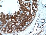 Cytokeratin 18 Antibody in Immunohistochemistry (Paraffin) (IHC (P))