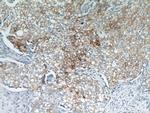 Cytokeratin 18 Antibody in Immunohistochemistry (Paraffin) (IHC (P))