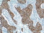 Cytokeratin 18 Antibody in Immunohistochemistry (Paraffin) (IHC (P))