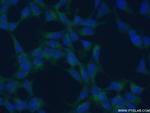 EPHX2 Antibody in Immunocytochemistry (ICC/IF)