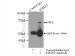 EPHX2 Antibody in Immunoprecipitation (IP)