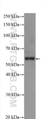 EPHX2 Antibody in Western Blot (WB)