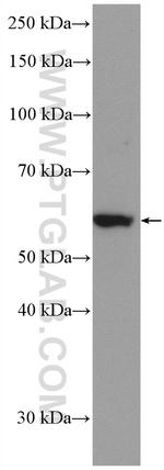 EPHX2 Antibody in Western Blot (WB)