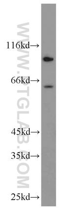 EPHX2 Antibody in Western Blot (WB)