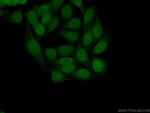 ATF4 Antibody in Immunocytochemistry (ICC/IF)