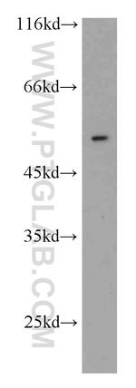 ATF4 Antibody in Western Blot (WB)