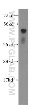 ATF4 Antibody in Western Blot (WB)