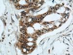 FOXO3A Antibody in Immunohistochemistry (Paraffin) (IHC (P))