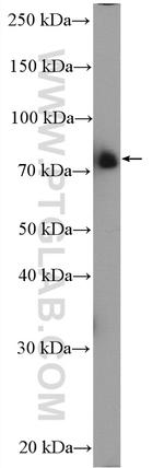 FOXO3A Antibody in Western Blot (WB)