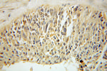 Palladin Antibody in Immunohistochemistry (Paraffin) (IHC (P))