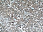 Palladin Antibody in Immunohistochemistry (Paraffin) (IHC (P))