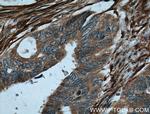 Palladin Antibody in Immunohistochemistry (Paraffin) (IHC (P))