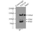 Palladin Antibody in Immunoprecipitation (IP)