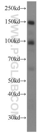 Palladin Antibody in Western Blot (WB)