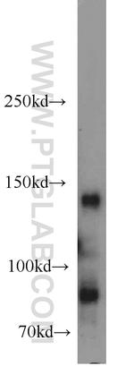 Palladin Antibody in Western Blot (WB)