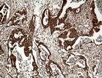 BLNK Antibody in Immunohistochemistry (Paraffin) (IHC (P))