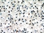 MECP2 Antibody in Immunohistochemistry (Paraffin) (IHC (P))