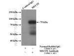 MECP2 Antibody in Immunoprecipitation (IP)