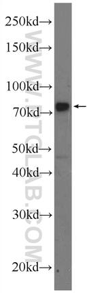 MECP2 Antibody in Western Blot (WB)