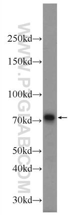 MECP2 Antibody in Western Blot (WB)