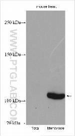 ATP1A3 (C-terminal) Antibody in Western Blot (WB)