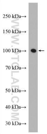 ATP1A3 (C-terminal) Antibody in Western Blot (WB)