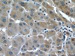 HSP47 Antibody in Immunohistochemistry (Paraffin) (IHC (P))