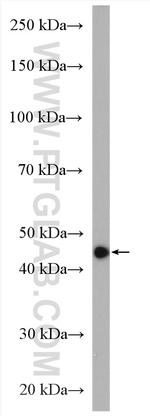 HSP47 Antibody in Western Blot (WB)