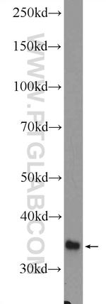 GLYAT Antibody in Western Blot (WB)